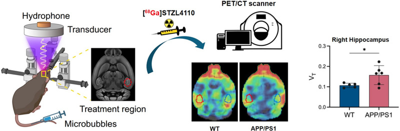 聚焦超声助力新型PET显像剂脑内递送，生医工学院合作新成果为阿尔茨海默症早期诊断提供新策略